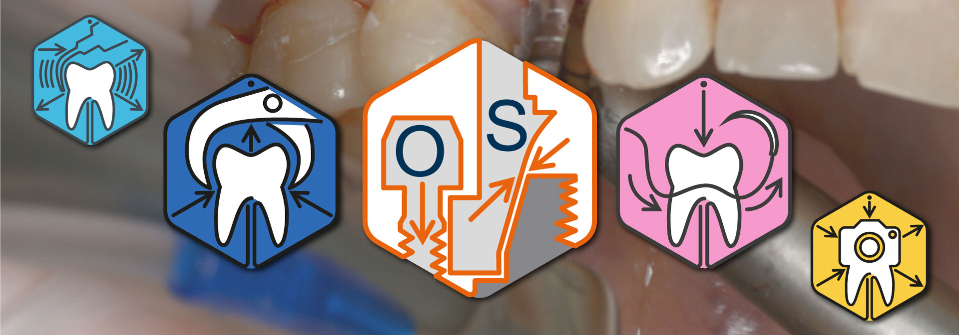 The most complete #Osstem surgery course