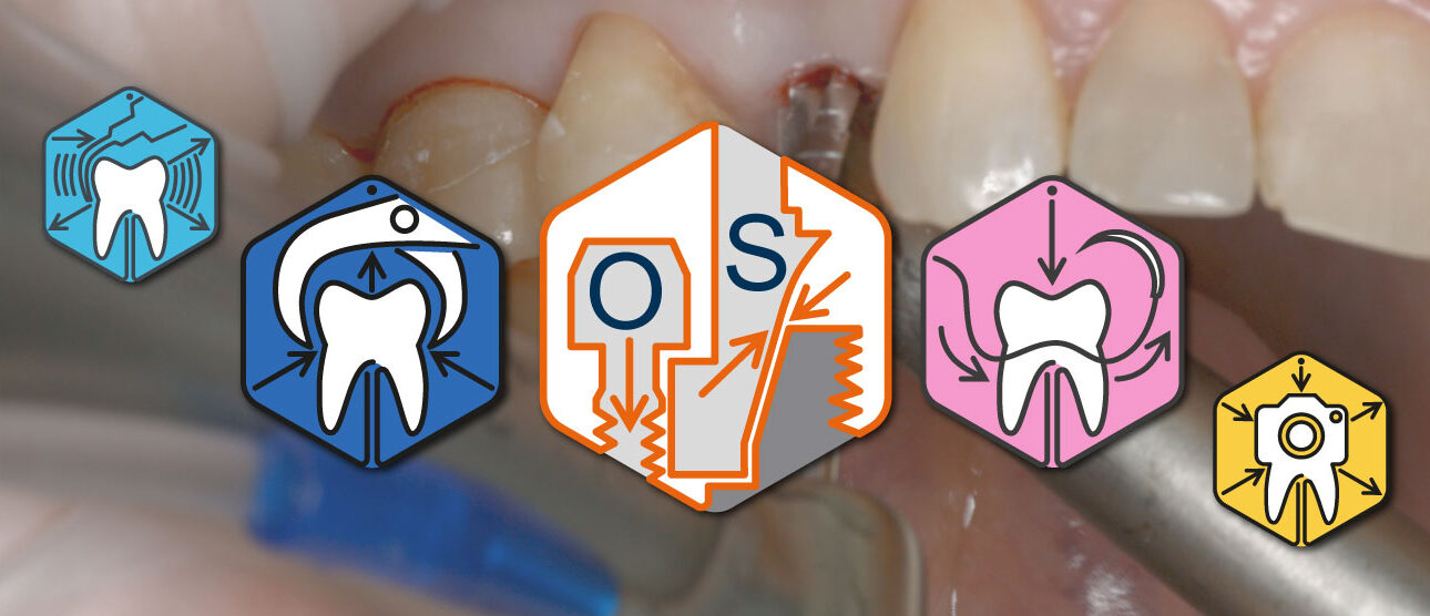 Osstem implantation system