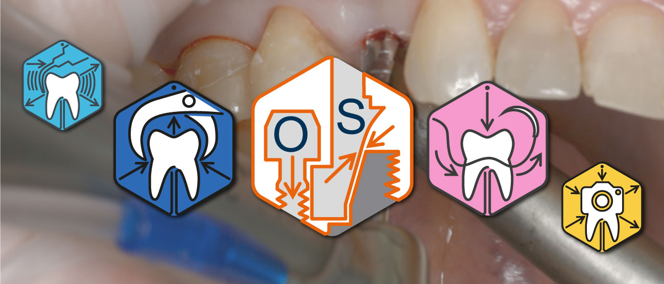 Osstem implantation system